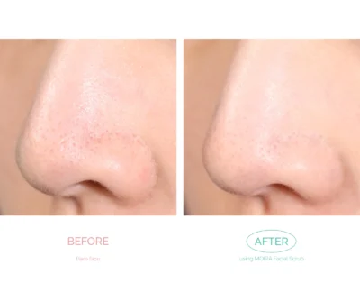 18db_Before_After-100 MOIRA Nourishing Avocado Facial Scrub